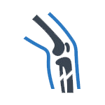 Joint Surgery Recovery & Rehabilitation